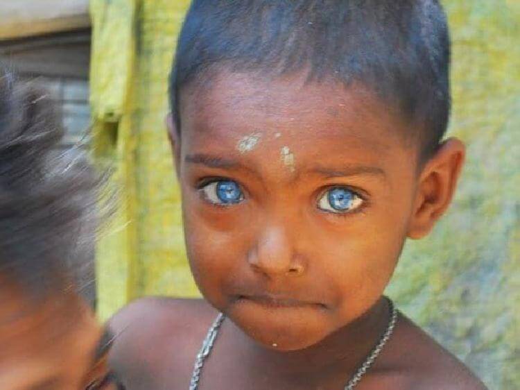 Темнокожие люди с голубыми глазами фото