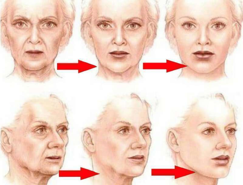 Возрастные изменения клеток. Возрастные изменения лица. Возрастные изменения лица у женщин. Анатомия старения лица. Стадии старения лица.